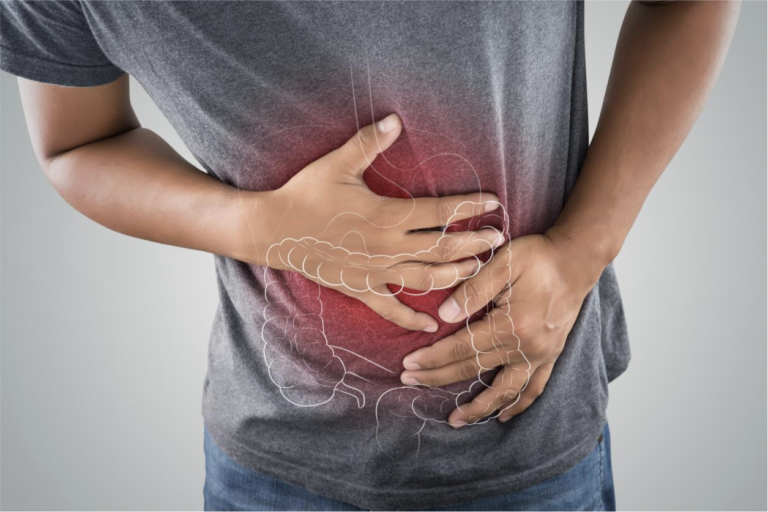 Differences Between Crohn's Disease and Colitis?